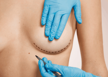 Guía completa para planificar tu cirugía plástica en Colombia: tiempos, precios y recuperación